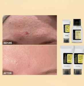 COSRX All About Snail Skincare Kit